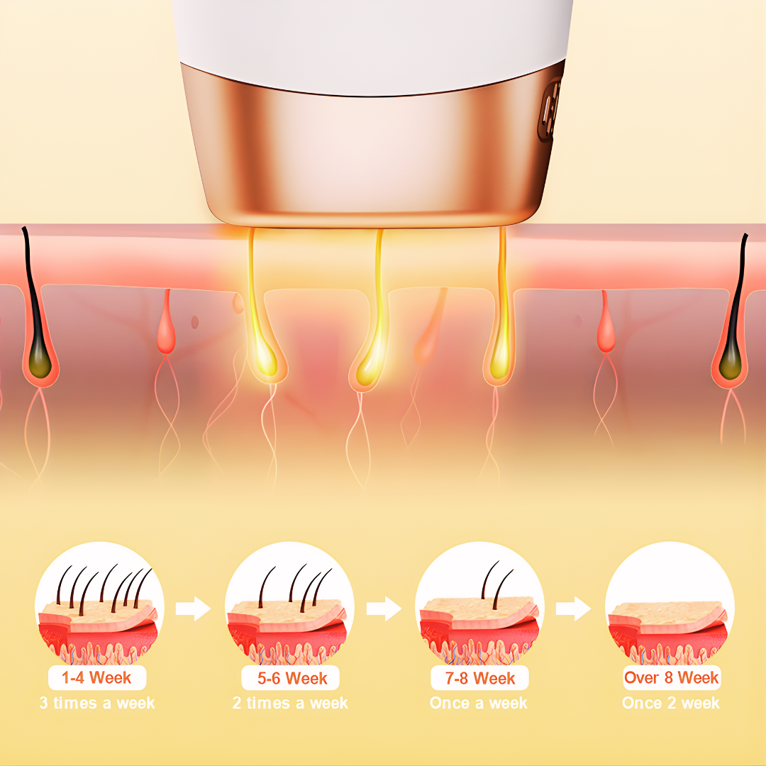 999,999 Flashes IPL Laser Hair Removal – Painless Home Use Permanent Hair Remover